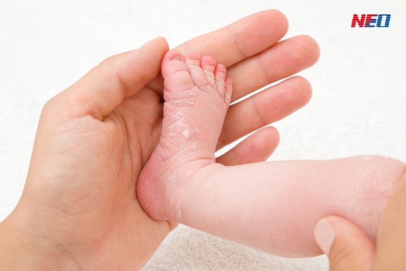 ทารกตัวลอก